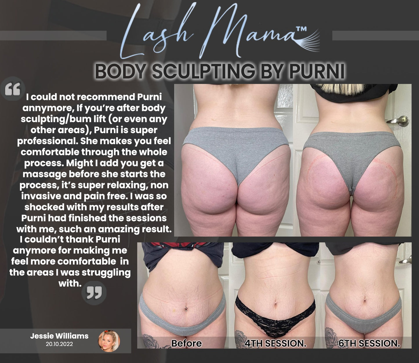 RF + Fat Cavitation + Lipo 6 In 1 Machine (Includes Shipping and 12 months warranty)